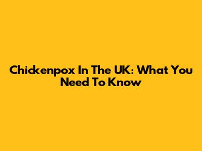 Chickenpox In The UK: What You Need To Know