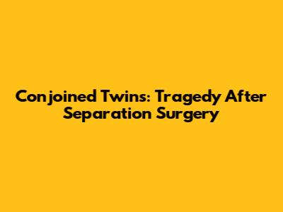 Conjoined Twins: Tragedy After Separation Surgery