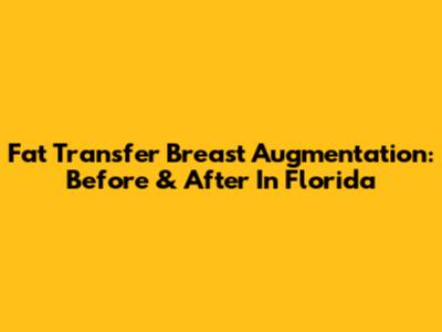 Fat Transfer Breast Augmentation: Before & After In Florida