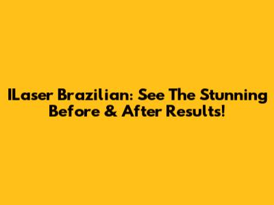 ILaser Brazilian: See The Stunning Before & After Results!