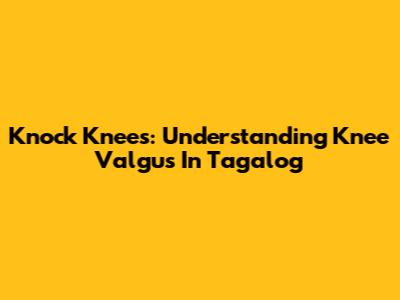 Knock Knees: Understanding 'Knee Valgus' In Tagalog