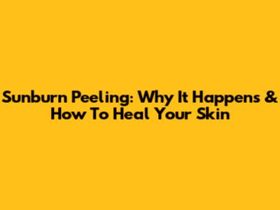 Sunburn Peeling: Why It Happens & How To Heal Your Skin